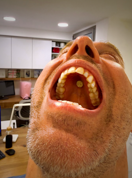 It adheres right to your palate